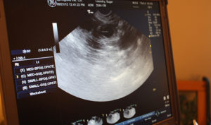 Canine Reproduction Sonogram